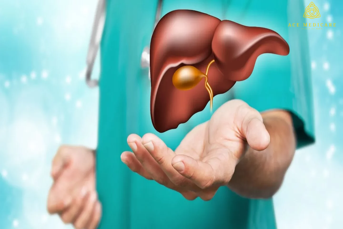 A Comprehensive Guide to Understanding Fatty Liver Disease: Causes, Symptoms, and Treatment Options